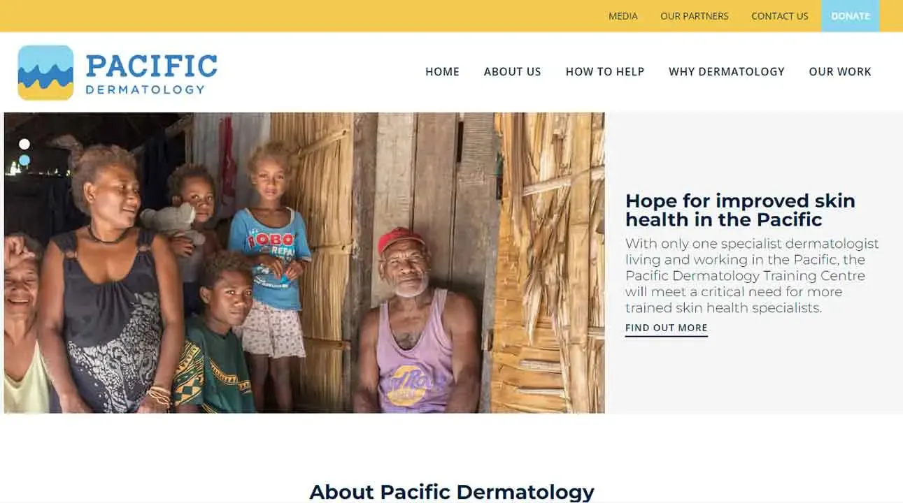 A diverse group of people stands and sits in a rustic room with thatched walls, showcasing the welcoming and communal atmosphere of a Pacific dermatology initiative.