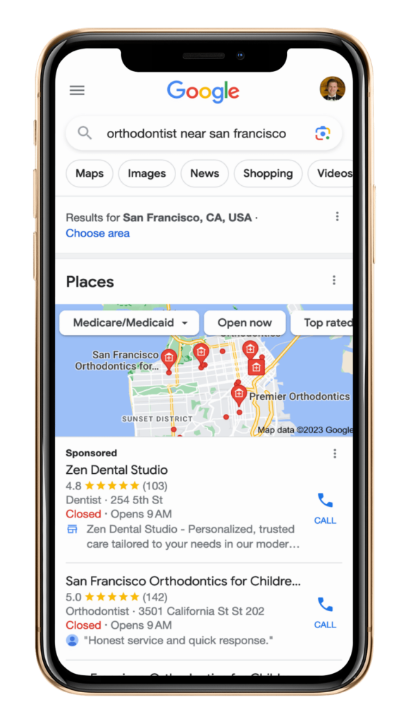 An example of a mobile search of "orthodontists near me" in San Francisco.